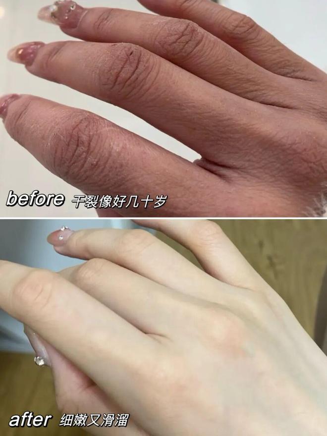 人试试这个外抹的方子一试就灵不朽情缘游戏网站址手足干裂的(图11)