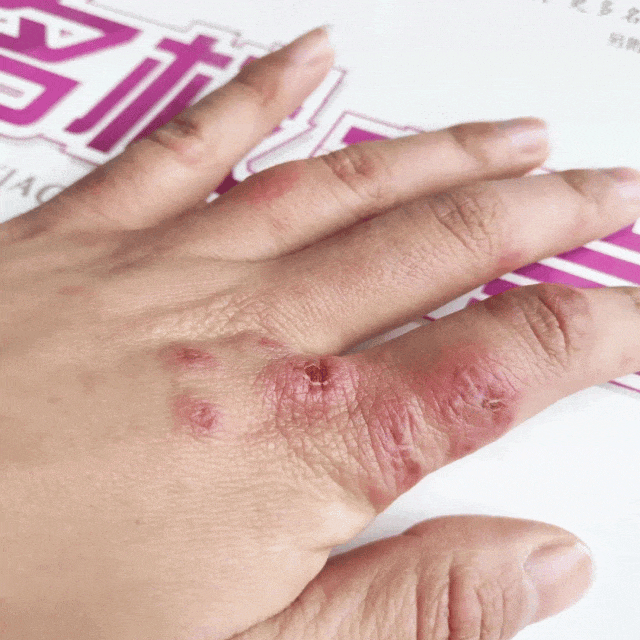 人试试这个外抹的方子一试就灵不朽情缘游戏网站址手足干裂的(图20)