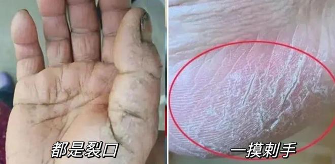 人试试这个外抹的方子一试就灵不朽情缘游戏网站址手足干裂的(图19)